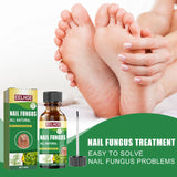 Nail Repair Solution Tea Tree Oil Essence Gentle Nourishing Manicure Cleansing Soft Nail Care Solution - V.I.P Digital Presence