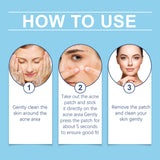 Day And Night Acne Cover Face Acne Patch Comfortably Repair Skin Oil Control Cover Acne Patch - V.I.P Digital Presence