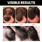 Batana Essential Oil, Hair Smoothing Anti-Loss Nourishing Skin Care Essential Oil - V.I.P Digital Presence