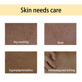 Handcrafted Body Oil, Slimming Massage Moisturizing And Firming Skin Body Care Essential Oil - V.I.P Digital Presence