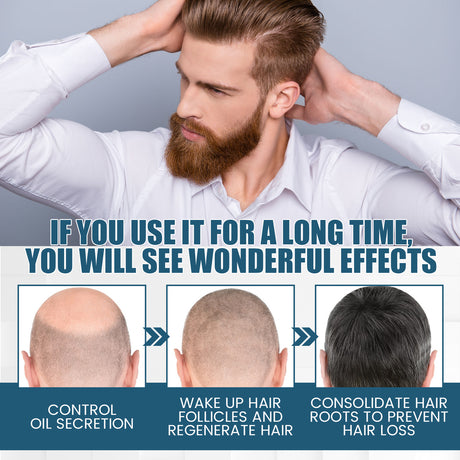 Hair Essence Spray, Prevent Hair Loss Repair Hair Dry And Frizzy Moisture And Dense Hair Essence - V.I.P Digital Presence