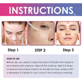 Freckle Removing Anti-aging Essence, Facial Firming Anti-wrinkle Lightening Melasma Stain Nourishing Skin Essence - V.I.P Digital Presence