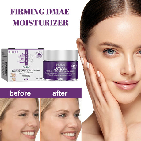 Moisturizer Improves Dry Skin Cream Tightens And Lightens Wrinkles Hydrating Moisturizing Moisture Easy To Absorb - V.I.P Digital Presence