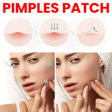 JaysuingRepair Acne Patch Facial Skin Care Fade Blemishes Pimple Marks Closed Acne Blemishes Cover Acne Pimple Repair Patch - V.I.P Digital Presence