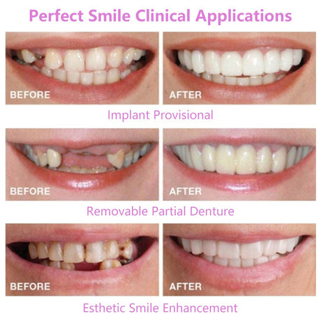 Simulation braces smile whitening sixth generation non-porous teeth set dentures - V.I.P Digital Presence