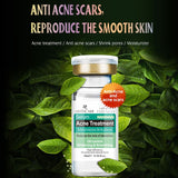 ARTISARE Acne Original Liquid essence - V.I.P Digital Presence