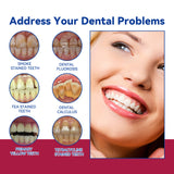Anti-Cavity Gum Health Toothpaste, Clean Teeth Yellow Stains And Tartar Breath Fresh Clean Tooth Care Toothpaste - V.I.P Digital Presence