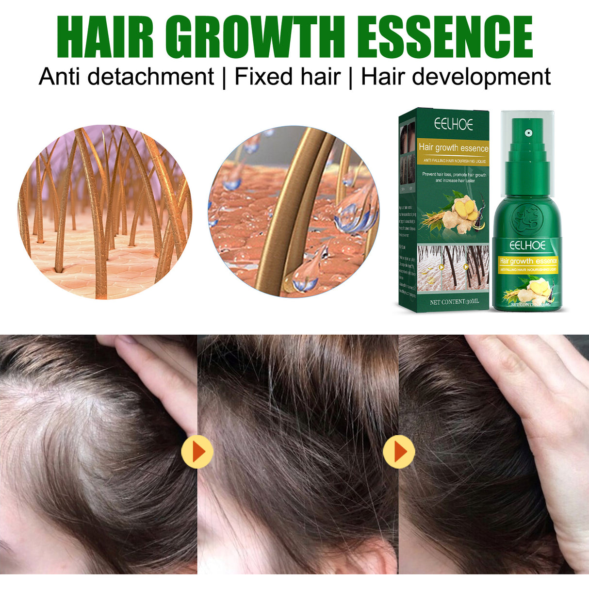 Ginger Hair Growth Spray, Nourishing And Nourishing Hair Root, Hair Care Solution To Prevent Scalp Loss - V.I.P Digital Presence