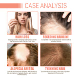 Grapefruit Hair Mist, Repair Damaged Hair Moisturizing And Thickening Hair Stabilization Spray - V.I.P Digital Presence