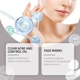 Set para el cuidado del acné, iluminador, hidratante suave, reparador de la piel, set facial hidratante