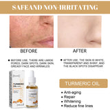 Turmeric Correction Essence Facial Care Hydrating Moisturizing Gentle Moisturizing Skin Care Essence - V.I.P Digital Presence