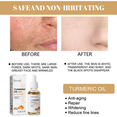 Turmeric Correction Essence Facial Care Hydrating Moisturizing Gentle Moisturizing Skin Care Essence - V.I.P Digital Presence