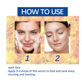 Dark Spot Repair Essence, Repair Acne Pimple Lightening Spot Fine Lines Moisturizing Firming Whitening Essence - V.I.P Digital Presence