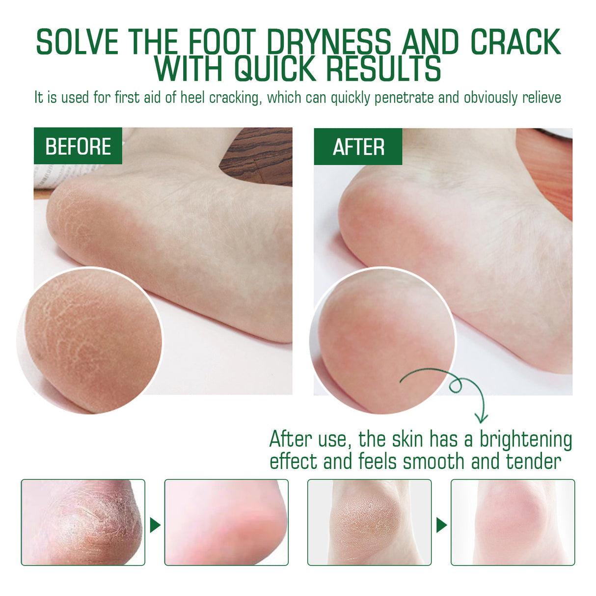 Crema para talones agrietados, reparadora, exfoliante, antiagrietante e hidratante.