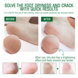 Crema para talones agrietados, reparadora, exfoliante, antiagrietante e hidratante.