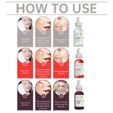 Set de limpieza facial para el acné, reparación del acné, blanqueamiento de la piel, set de mascarillas con esencia para el acné