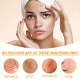Facial Treatment Essence, Lighten Facial Acne Mark Oil Control Firming Skin Essence - V.I.P Digital Presence