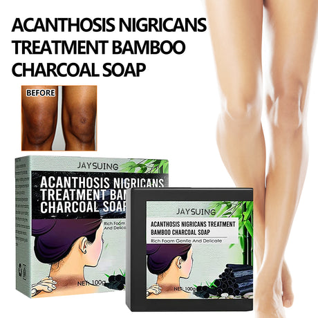 Underarm Whitening Soap, Clean And Repair Dark Skin Acanthosis Nigricans Moisturizing Whitening Beauty Soap - V.I.P Digital Presence