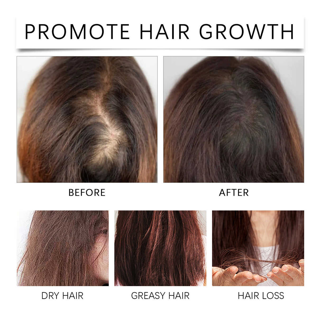 Palm Oil Hair Care Essence, Scalp Massage Treatment Repair Dry Hair, Soft And Solid Hair - V.I.P Digital Presence