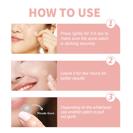 Acne Patch, Repair Acne Pimple Facial Redness Clean Pores Moisturize Skin Patch - V.I.P Digital Presence