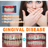 Tooth Repair Essence, Cleaning Teeth Stains Tartar Care Gums Oral Care Essence - V.I.P Digital Presence