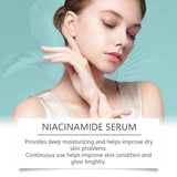 Nicotinamide Brightening Serum, Gently Nourishing, Hydrating And Brightening Facial Skin Moisturizing And Skincare Essence - V.I.P Digital Presence
