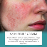 Crema para el cuidado del folículo piloso Cuidado del cuero cabelludo Espalda Rostro Limpieza Reparación Acné Crema para el cuidado del folículo piloso