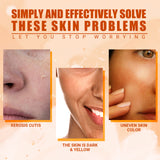 Vitamin C Moisturizing Spray Hydrates And Moisturizes Skin, Lightening Acne Spots And Whitening Spray - V.I.P Digital Presence