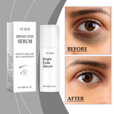 Eye Essence Moisturizes And Tightenes The Skin Around The Eyes, Lightening The Fine Lines And Bags Under The Eyes - V.I.P Digital Presence
