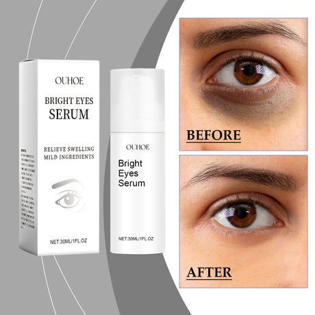 Eye Essence Moisturizes And Tightenes The Skin Around The Eyes, Lightening The Fine Lines And Bags Under The Eyes - V.I.P Digital Presence