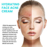 Brightening Anti-Acne Cream, Lighten Acne Pimples, Shrink Pores, Moisturize Skin Brightening Cream