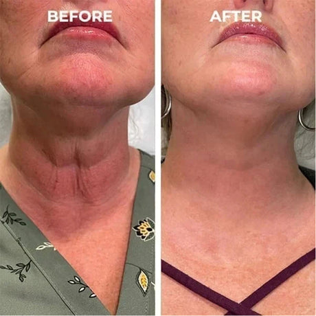 Facial Essence, Lifts And Tightens Facial Skin And Reduces Fine Lines And Wrinkles - V.I.P Digital Presence