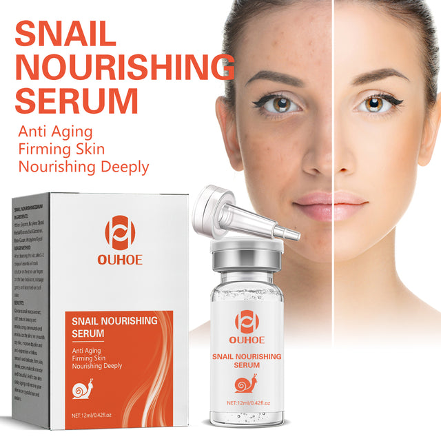 Snail Nourishing Repair Essence, Lightening Acne Muscle Acne Mark, Hydrating Whitening And Eliminate Pimples Essence - V.I.P Digital Presence