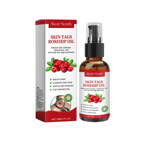 Rosehip Seed And Wart Essence Oil, Moisturizes And Restores Smooth Skin - V.I.P Digital Presence