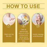 Bee Venom Wart & Mole Removal Spray, Gentle Cleansing Skin Moisturizing Moisturizing Smooth Skin Care - V.I.P Digital Presence