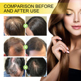 Black Seed Oil Essence To Improve Dry Hair, Nourish And Repair Damaged Hair And Prevent Hair Loss - V.I.P Digital Presence