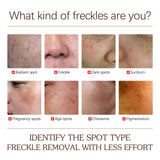 Peel Mask, Removing Spots Hydrating Firming And Brightening Skin Mask