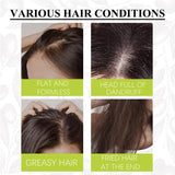 Artemisea Anti-Dandruff Scalp Pigment, Clean Scalp, Relieve Itching And Oil Control, Repair Frizz Damaged Hair Care - V.I.P Digital Presence