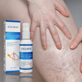 Intravenous Massage Spray For Varicose Veins Relief And Earthworm Leg Blood Vessel Bulge Pain Spray - V.I.P Digital Presence