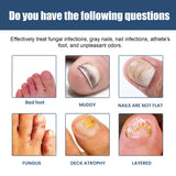 Nail Care Spray Gently Cleans Foot Nails Moisturizing And Brightening Nail Care Spray - V.I.P Digital Presence