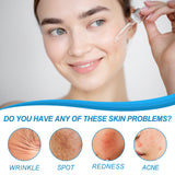 B5 Facial Essence, Lightening Spot Soft Skin Anti-aging Moisturizing Essence - V.I.P Digital Presence