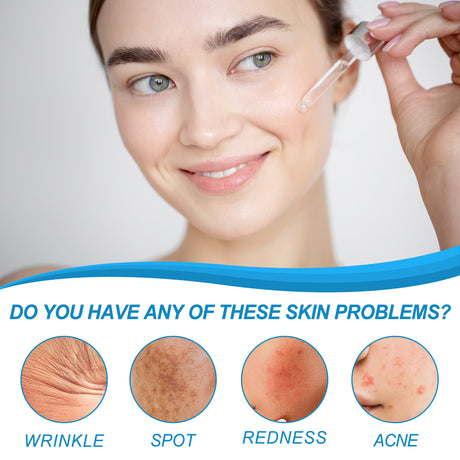 B5 Facial Essence, Lightening Spot Soft Skin Anti-aging Moisturizing Essence - V.I.P Digital Presence