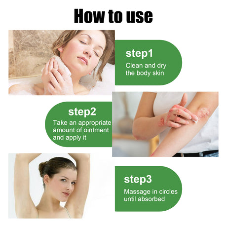 Herbal Eczema Ointment, Relieve Hand And Foot Moss Skin Redness Itchy Skin Repair Ointment - V.I.P Digital Presence