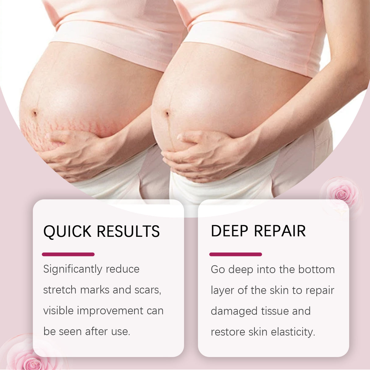 Skin Care Oil Moisturizes Postpartum Skin Fine Lines And Enhances Elasticity With A Moisturizing Cream For The Body - V.I.P Digital Presence