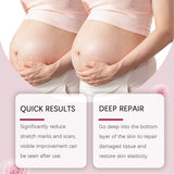 Skin Care Oil Moisturizes Postpartum Skin Fine Lines And Enhances Elasticity With A Moisturizing Cream For The Body - V.I.P Digital Presence