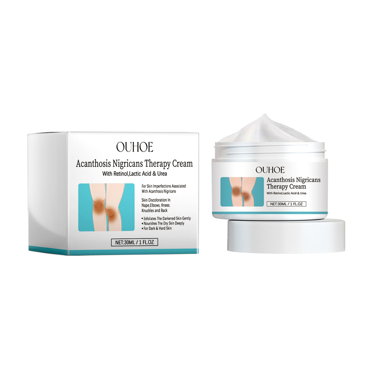 Acanthosis Nigricans Therapy Cream, Repair Dull Skin Lightening Joint Black Moisturizing Whitening Skin Care Cream - V.I.P Digital Presence