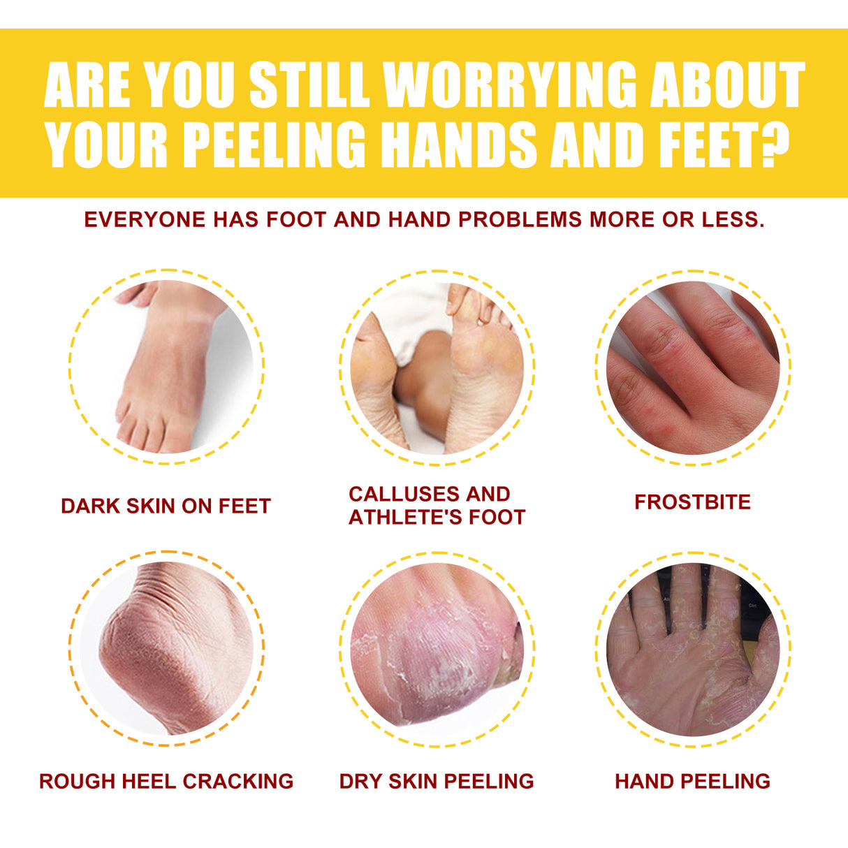 Horse Oil Hand And Foot Repair Cream, Chapped Skin Care Moisturizing And Anti-Peeling Repair Cream - V.I.P Digital Presence