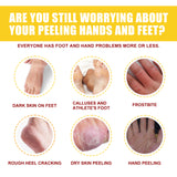 Horse Oil Hand And Foot Repair Cream, Chapped Skin Care Moisturizing And Anti-Peeling Repair Cream - V.I.P Digital Presence