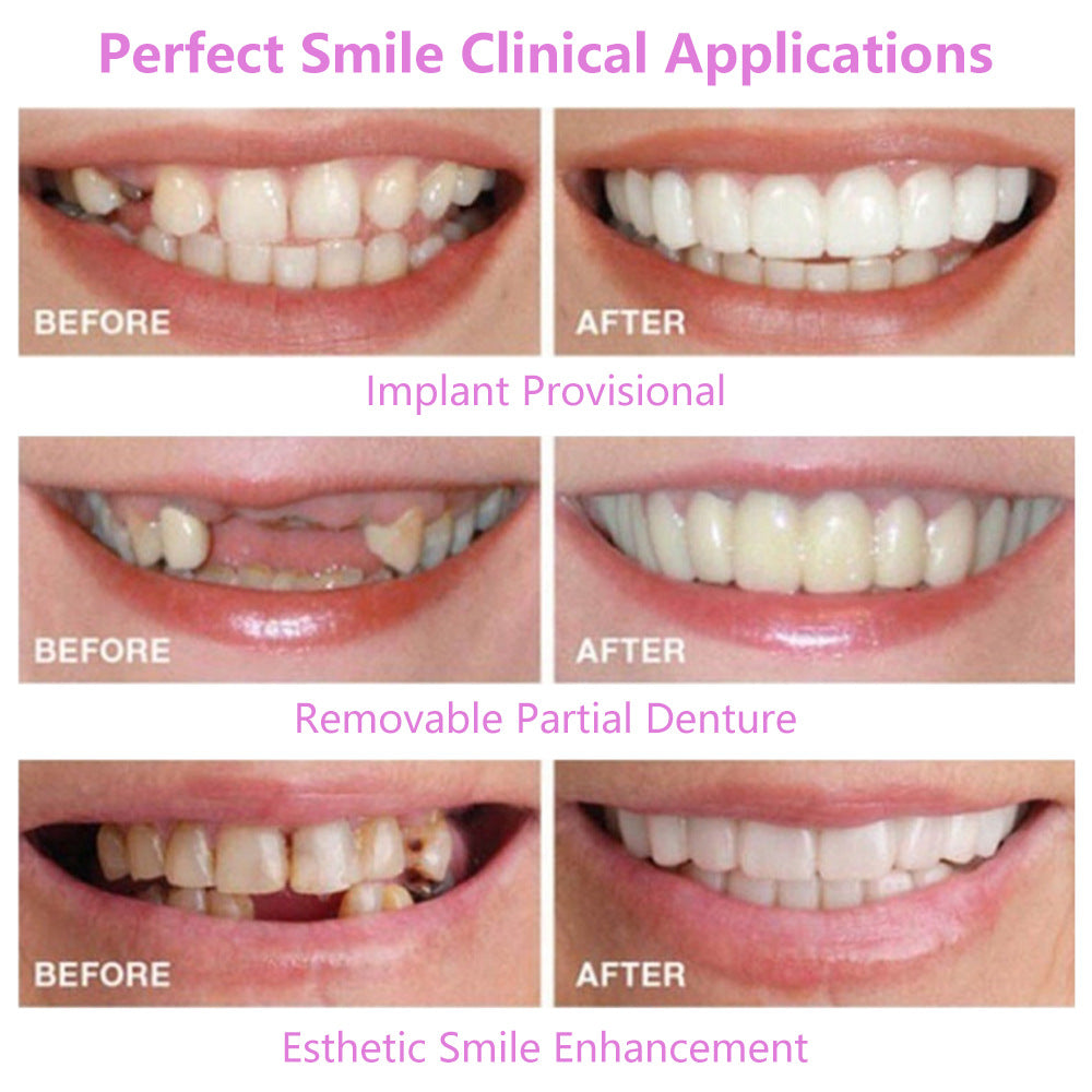 Upper Teeth And Lower Teeth Simulation Braces Non-Porous Braces Whitening Sleeves Second-Generation Silicone Simulation Teeth Dentures - V.I.P Digital Presence