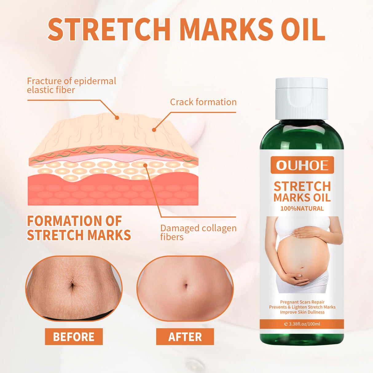 Pregnancy Massage Oil, Repair Pregnant Women Prenatal And Postpartum Stretch Mark Skin Care Massage Oil - V.I.P Digital Presence
